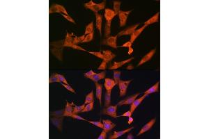 anti-Ubiquitin Specific Peptidase 10 (USP10) antibody