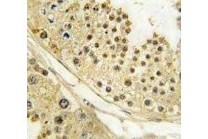 IHC analysis of FFPE human testis tissue stained with Aurora B antibody (Aurora Kinase B anticorps  (AA 6-35))
