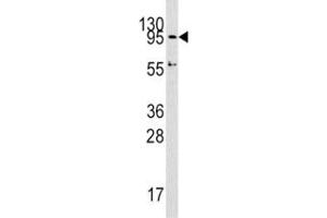 Western blot analysis of Dnmt3a antibody and HepG2 lysate.