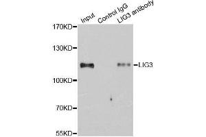 Immunoprecipitation analysis of 200ug extracts of Jurkat cells using 1ug LIG3 antibody. (LIG3 anticorps)