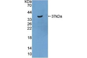 Western blot analysis of recombinant Human STATH. (STATH anticorps  (AA 1-62))