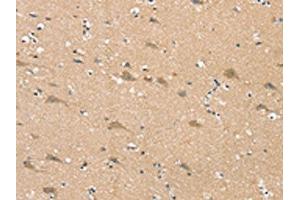 The image on the left is immunohistochemistry of paraffin-embedded Human brain tissue using ABIN7192347(SGPL1 Antibody) at dilution 1/25, on the right is treated with synthetic peptide. (SGPL1 anticorps)