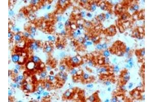 IHC testing of FFPE human liver with DGAT2 antibody at 3ug/ml. (DGAT2 anticorps)