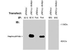 Western blot of Nephrophthisis (pic) polyclonal antibody  used at 2! (NPHP1 anticorps  (AA 612-691))