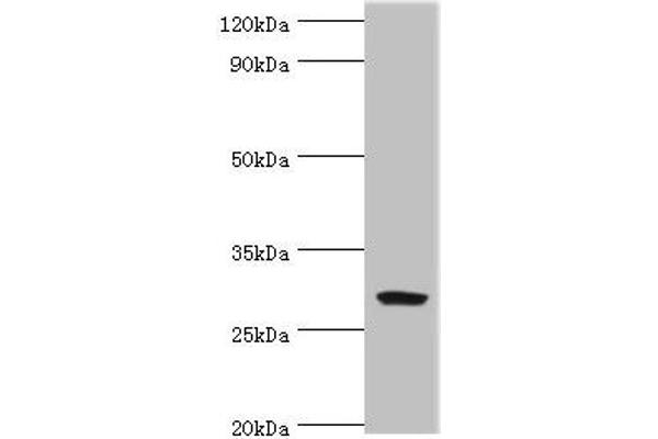 Spindlin 2B anticorps  (AA 1-258)