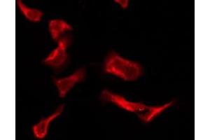 ABIN6276198 staining HeLa by IF/ICC. (P2RY4 anticorps  (C-Term))