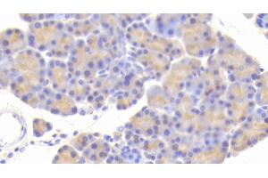 Detection of CPA1 in Rat Pancreas Tissue using Polyclonal Antibody to Carboxypeptidase A1, Pancreatic (CPA1)