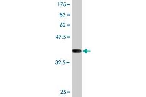 Western Blot detection against Immunogen (36. (ATG5 anticorps  (AA 176-275))