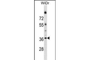 ALG5 Antibody (Center) (ABIN1538598 and ABIN2849400) western blot analysis in WiDr cell line lysates (35 μg/lane). (ALG5 anticorps  (AA 74-100))