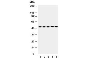 Western blot testing of 1) rat liver, 2) mouse liver, 3) human SMMC, 4) RH35 and 5) HepG2 lysate with YB1 antibody. (YBX1 anticorps)
