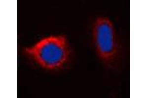 Immunofluorescent analysis of Calnexin (pS583) staining in HeLa cells. (Calnexin anticorps  (C-Term, pSer583))