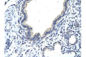 Rabbit Anti-DDX21 antibody   Paraffin Embedded Tissue: Human Lung cell Cellular Data: cilia of renal tubule Antibody Concentration: 4.