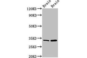 Western Blot Positive WB detected in: Mouse brain tissue, Rat brain tissue All lanes: HAX1 antibody at 1. (HAX1 anticorps  (AA 2-250))