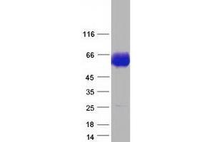 Acid Phosphatase 2, Lysosomal (ACP2) (Transcript Variant 1) protein (Myc-DYKDDDDK Tag)