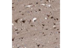 Immunohistochemical staining of human cerebral cortex with KANSL1 polyclonal antibody  shows strong cytoplasmic and nuclear positivity in neuronal cells. (KANSL1 anticorps)