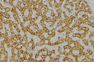 ABIN6276770 at 1/100 staining Mouse liver tissue by IHC-P. (DPYD anticorps  (Internal Region))