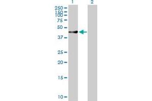 Western Blot analysis of RUSC1 expression in transfected 293T cell line by RUSC1 MaxPab polyclonal antibody. (RUSC1 anticorps  (AA 1-433))
