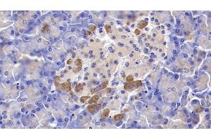 Detection of OPG in Human Pancreas Tissue using Polyclonal Antibody to Osteoprotegerin (OPG)