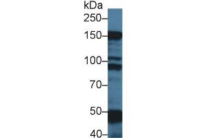 Western Blot; Sample: Rat Skeletal muscle lysate; Primary Ab: 1µg/ml Rabbit Anti-Mouse MYBPC1 Antibody Second Ab: 0. (MYBPC1 anticorps  (AA 1-277))