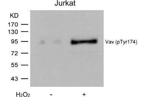 Western blot analysis of extracts from Jurkat cells untreated or treated with H2O2 using Vav(Phospho-Tyr174) Antibody. (VAV1 anticorps  (pTyr174))