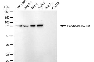 Western blotting analysis using Forkhead box O3 antibody (ABIN7798645).