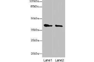 Western blot All lanes: GPR17 antibody at 10 μg/mL Lane 1: Mouse brain tissue Lane 2: Human high value serum Secondary Goat polyclonal to rabbit IgG at 1/10000 dilution Predicted band size: 41, 38 kDa Observed band size: 41 kDa (GPR17 anticorps  (AA 1-36))