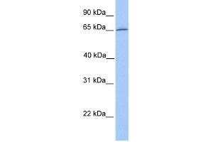 WB Suggested Anti-DYNC1I1 Antibody Titration: 0. (DYNC1I1 anticorps  (N-Term))