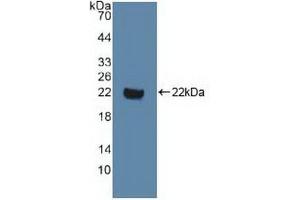 Detection of Recombinant DVL1, Human using Polyclonal Antibody to Dishevelled, Dsh Homolog 1 (DVL1)
