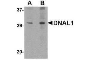 Western blot analysis of DNAL1 in 3T3 cell lysate with AP30294PU-N DNAL1 antibody at (A) 1 and (B) 2 μg/ml. (DNAL1 anticorps  (C-Term))