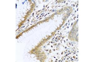 Immunohistochemistry of paraffin-embedded human stomach using TMEM189 antibody (ABIN6134447, ABIN6149262, ABIN6149263 and ABIN6224423) at dilution of 1:100 (40x lens). (TMEM189 anticorps  (C-Term))