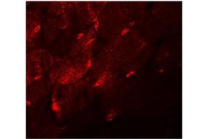 Immunofluorescence of TMEM38A in mouse skeletal muscle tissue with TMEM38A antibody at 20 μg/ml. (TMEM38A anticorps  (C-Term))