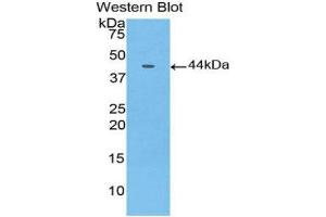 Western Blotting (WB) image for anti-Gastrointestinal Cancer Antigen CA19-9 (CA 19-9) (AA 35-361) antibody (ABIN5661981) (CA 19-9 anticorps  (AA 35-361))