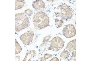 Immunohistochemistry of paraffin-embedded human stomach using CLUH antibody  at dilution of 1:100 (40x lens). (CLUH anticorps  (AA 1120-1309))