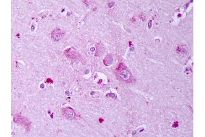 Anti-GABRB1 antibody IHC of human brain, cortex neurons. (GABRA1 anticorps  (AA 327-450))