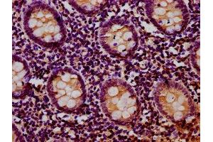 anti-RIO Kinase 2 (RIOK2) (AA 316-448) antibody