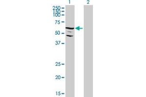 Western Blot analysis of C9orf96 expression in transfected 293T cell line by C9orf96 MaxPab polyclonal antibody. (C9orf96 anticorps  (AA 1-680))