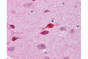 Anti-WNT5A antibody IHC of human brain, cortex.