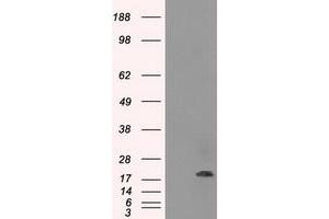 Image no. 1 for anti-Crystallin, alpha B (CRYAB) antibody (ABIN1497644) (CRYAB anticorps)