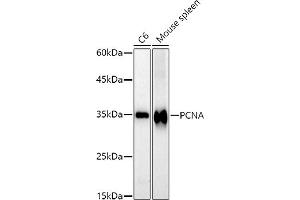 Western blot analysis of extracts of various cell lines, using PCNA antibody (ABIN6133630, ABIN6139020, ABIN6139022 and ABIN7101400) at 1:1000 dilution. (PCNA anticorps)