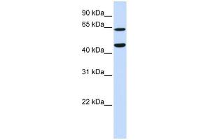 WB Suggested Anti-TRIM54 Antibody Titration:  0. (TRIM54 anticorps  (N-Term))