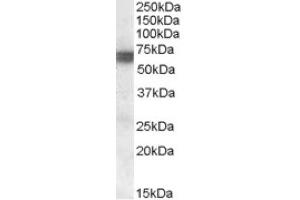 Image no. 1 for anti-Bridging Integrator 1 (BIN1) (Internal Region) antibody (ABIN375175)