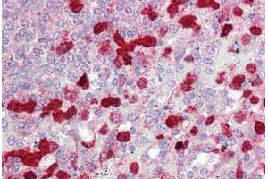 Anti-CLIC4 antibody IHC staining of human spleen. (CLIC4 anticorps  (AA 1-50))