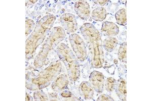 Immunohistochemistry of paraffin-embedded rat kidney using Aquaporin-1  Rabbit pAb (ABIN7265651) at dilution of 1:100 (40x lens). (Aquaporin 1 anticorps  (C-Term))