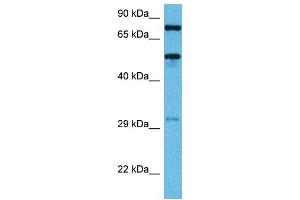 Host:  Mouse  Target Name:  TFE3  Sample Tissue:  Mouse Heart  Antibody Dilution:  1ug/ml (TFE3 anticorps  (Middle Region))