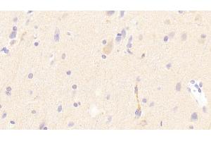 Detection of LDLR in Human Cerebrum Tissue using Polyclonal Antibody to Low Density Lipoprotein Receptor (LDLR)