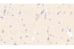 Detection of LDLR in Human Cerebrum Tissue using Polyclonal Antibody to Low Density Lipoprotein Receptor (LDLR) (LDLR anticorps  (AA 497-742))