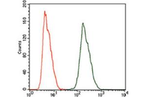 Immunohistochemical analysis of paraffin-embedded cervical cancer tissues using ALDH2 antibody with DAB staining.