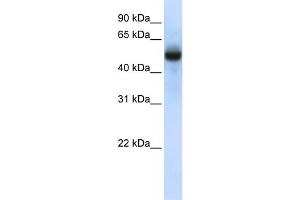 WB Suggested Anti-CXorf34 Antibody Titration:  0. (TRMT2B anticorps  (N-Term))