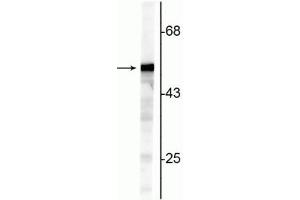 Western blot of NIH 3T3 cell lysate showing specific immunolabeling of the ~50 kDa Vimentin protein. (Vimentin anticorps)