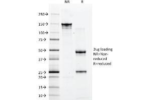 SDS-PAGE Analysis Purified CD2 Mouse Monoclonal Antibody (1E7E8.